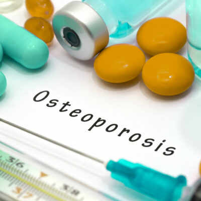 Early Symptoms of Osteoporosis