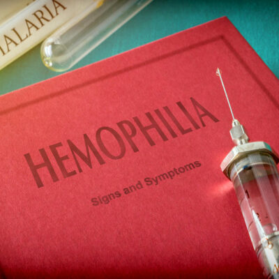 Hemophilia: Types, Symptoms, Causes, and Risks